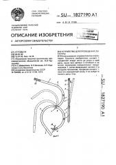 Устройство для проведения лигатуры (патент 1827190)