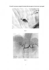 Способ эндоваскулярной химиоэмболизации печеночных артерий (патент 2655191)