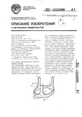 Каркас биологического протеза клапана сердца (патент 1323099)