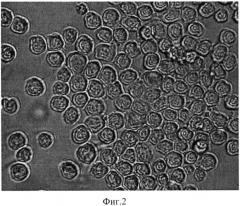 Штамм гибридных культивируемых клеток животных mus musculus α-продуцент моноклональных антител, специфичных к гранулоцитарному колониестимулирующему фактору (gcsf) человека (патент 2542381)