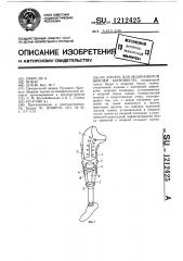 Протез для недоразвитой нижней конечности (патент 1212425)