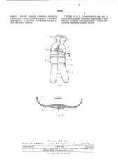 Шина для лечения сколиоза (патент 249556)