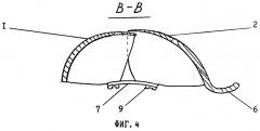 Ацетабулярная опора (патент 2256428)