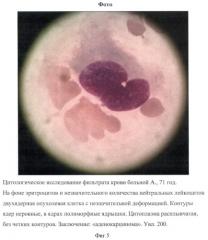 Способ определения раковых клеток в периферической венозной крови у больных с подозрением на злокачественные новообразования (патент 2425385)