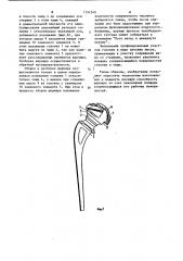 Сферический шарнир (патент 1151240)