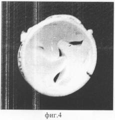 Бескаркасный протез корня аорты (патент 2293543)