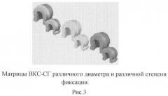 Способ изготовления дополнительных замковых креплений для бюгельных телескопических протезов (патент 2463994)