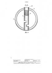 Приемная гильза протеза бедра (патент 1308325)