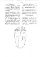 Эндопротез мышечной группы (патент 1516110)