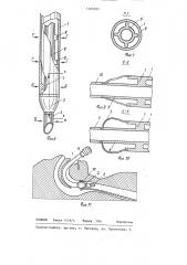 Трахеальная трубка (патент 1306583)