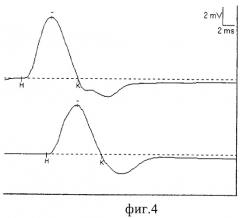 Способ лечения повреждений периферических нервов (патент 2294225)
