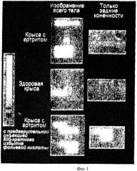 Лечение и диагностика заболеваний, опосредованных макрофагами (патент 2480241)