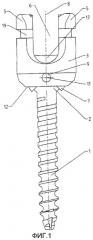 Спинальный шуруп (патент 2549017)