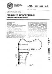 Фиксатор для деторсионной остеотомии (патент 1421330)