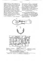 Протез предплечья с биоэлектрическим управлением для детей (патент 766594)