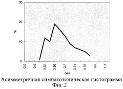 Способ оценки эффективности лечения у больных безболевой ишемией миокарда с различными типами вегетативной направленности (патент 2276574)