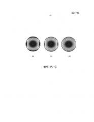 Система контактных линз для невращательно-симметричной аберрации глаза для обеспечения максимального комфорта ношения (патент 2665203)