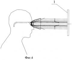 Устройство для исследования периферийных областей поля зрения (патент 2477070)