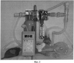 Аппарат ингаляционного наркоза (патент 2466749)