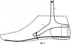 Искусственная стопа и способ управления ее движением (патент 2419398)
