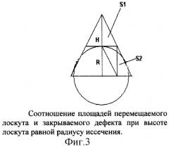 Способ сочетанного закрытия дефекта кожи местными тканями и свободными кожными лоскутами (патент 2326609)