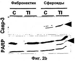 Комбинированная терапия, использующая антиангиогенные средства и tnf-  (патент 2316337)