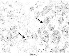 Способ лечения экспериментальных животных с высокой частотой спонтанного опухолеобразования (патент 2481849)