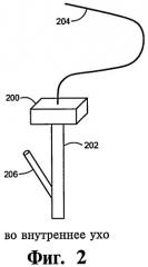 Система связи с внутренним ухом (патент 2465876)