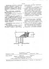 Гигиеническая щетка (патент 1341453)