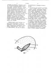 Способ лечения стеноза устья мочеточника у детей (патент 1378821)