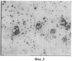 Способ озон/no-ультразвуковой дезинтеграции суспензий опухолевых клеток и их агрегатов (патент 2433178)