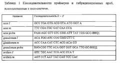 Способ количественного определения видового состава пропионовых бактерий, обитающих на коже человека (патент 2542477)