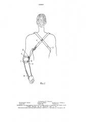Крепление протеза верхней конечности (патент 1554907)