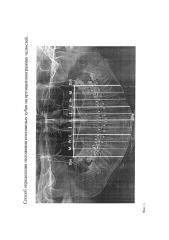 Способ определения положения постоянных зубов на ортопантомограммах челюстей (патент 2649212)