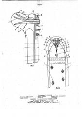 Устройство для остеосинтеза переломов шейки бедренной кости (патент 984469)