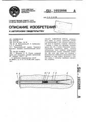 Анкерная крепь (патент 1055886)