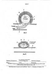 Окклюзирующее устройство (патент 1618417)