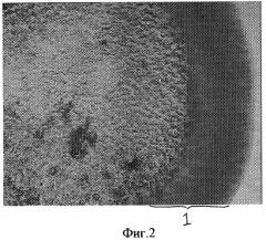 Способ прижизненного определения вида органических камней желчного пузыря (патент 2299436)