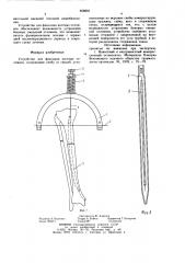 Устройство для фиксации костных отломков (патент 858803)