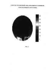 Способ трехмерной локализации источников электроэнцефалограммы (патент 2584086)