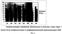 Способ повышения функциональной активности сетчатки при ее патологии различного генеза (патент 2364382)