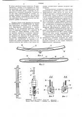 Устройство для тренировки ног пловцов (патент 1069840)