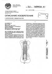 Устройство для компрессионного остеосинтеза отломков трубчатых костей (патент 1659034)