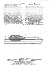 Фидерная линия переменной длины (патент 964792)