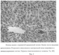 N-[3-оксо-лупано-28-ил]-пиперидин-средство с противоопухолевой, антиметастатической, противовоспалительной и цитопротекторной активностью (патент 2466136)