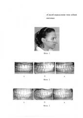 Способ определения типа зубной системы (патент 2626699)