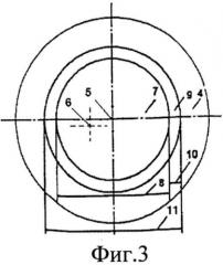 Способ хирургической коррекции сложного неправильного гиперметропического роговичного астигматизма (патент 2553195)