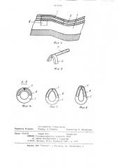 Интубационная трубка (патент 1217422)