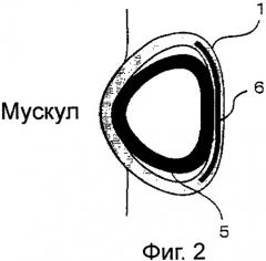 Устройство для укрепления мускулов (патент 2329846)