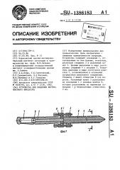 Устройство для введения внутрикостного фиксатора (патент 1386183)